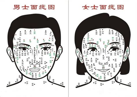 右邊臉頰有痣|「臉痣」看健康、運勢！專家解析10種痣：眼下這顆痣。